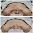 힐링스파 이미지