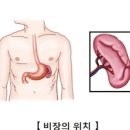 비장 기능 위치 비장비대증 원인 통증 간략하게 정리해 봄 이미지