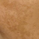 유앤아이의원 안산점 | 안산레이저토닝, 만족도 높게 받는 방법 3가지