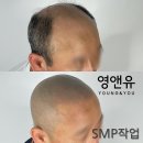 영앤유