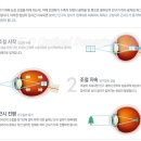 아이큐안경 이미지