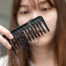 "혹시 나도?" 2030 '영 탈모' 급증…의사 피셜 '진짜 관리법' 이미지