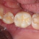 네츄럴치과기공소 이미지