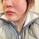 반딧불의원 | 잡티 주근깨 레이저 반딧불의원