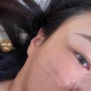 단아연한의원 | [서울/건대입구역] 단아연한의원 극초단파 리프팅 후기