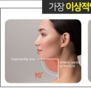 스펀지성형외과의원 네이버블로그