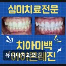 유니나치과의원 네이버블로그