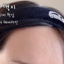 인동35길-1 | 구미 인동 왁싱 헤어라인 이마라인 후기 백지