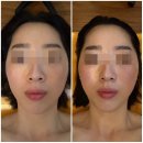 경애체형관리 | 대구웨딩케어 작은얼굴관리 비대칭관리 만족 후기