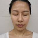 허니부쉬로 담아낸 화려화 (3주섭취 전후사진 有)