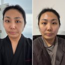 창동중앙점 | 창동 에스테틱 경락 40대 후기