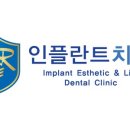 인플란트치과의원 이미지