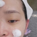 일산여드름 압출전문 에셀스킨 광채피부 관리후기