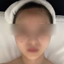 망울 | 부산 전포 웨딩관리로 좋은 코아페이즈 윤곽관리 솔직후기 (이중턱, 안면비대칭)