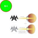 용봉택지로R | 고도원시 고도난시 노안 그리고 최근 녹내장치료까지 하는데 다초점안경 괜찮을까?