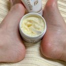 발 뒤꿈치 갈라짐과 각질. 발데렐라 풋크림으로 케어 완료!