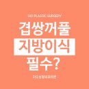 겹쌍커풀 교정할 때 아이홀 지방이식 필수인가요 이미지