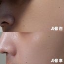 메디하이 | 쿠쿠 메디킨 하이 탄력잠금단 솔직 후기｜얼굴, 턱, 바디 탄력 가장 좋았던 효과는?