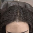 네일샵에스 아를솔즈 문제성발톱 발각질 네일