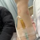 새부천성 | 부천삼성미래산부인과 출산후기 : 자분실패제왕출산..