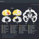 하나메디텍 이미지