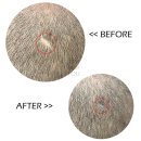 분당-246 | 본인도 몰랐던 땜빵 | 부분 탈모 두피문신 후기 | 용인두피문신 분당두피문신