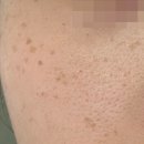 휴아이안과의원 이미지