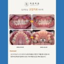 리온치과의원 네이버블로그