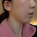 대구 피팅 리프팅 다이어트수액 잘하는 병원 내돈내산 후기