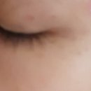 공업탑강남피부과의원 이미지