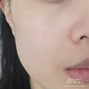 엠제이코스메틱 | 속건조를 잡아주는 피부과화장품 브탭티브 액티브리프팅 코스메틱세트