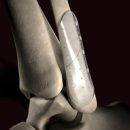 정형메디텍 이미지