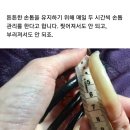 마녀손톱 - 창원시 마산회원구 | 마녀손톱