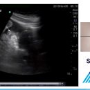 04 Peritoneum 이미지
