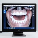 굿플랜치과의원 | 이게 바로 찐 후기! 연세 굿 프 란 트 치과의 찐 매력 탐구