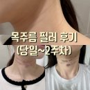 차잘고치는집 | 미루고 미뤘던 목 주름.. 한티역 피부과에서 목주름 필러 3줄 맞은 완전 솔직후기♥ (내돈내맞/당일~2주차)