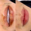 스타펠리스앞 | 천안 뷰티문 남자입술반영구 중화 시술 후기, 밝은 인상으로 변화된 순간