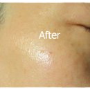 퍼비스코리아 이미지