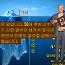 신장 결석 치료 방법 및 사례 - 비과학적 양의학 207 - 사암침, 사암침법, 정통사암침 이미지