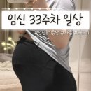 임신 33주차 일상｜임신 후기 증상, 태아 딸꾹질, 초음파 머리카락, 그 외 일상기록🌿