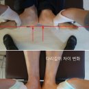 바른자세운동 이미지