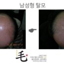 불로장생모