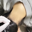 무드부띠끄 왁싱 | 안양웨딩관리 평촌 무드부띠끄왁싱 뒷목왁싱 후기 (안양웨딩왁싱 전문)