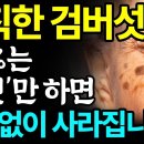 집에서 검버섯 없애는 방법 3가지 총정리! 피부과에 헛돈 쓰지마세요! 따라만 하면 검버섯, 기미 번지지 않고 싹 다 사라집니다! 이미지