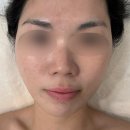 원영크레온오피스텔 | 안산 윤곽관리 얼굴라인 살아난 아로벨뷰티 리프팅 후기