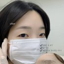하버드어린이집 | 순천두피문신 후기, 5년 탈모 콤플렉스 이렇게 해결했어요 (림오브제 방문기)
