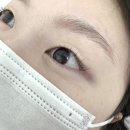아이포유 | [보라매 속눈썹펌/아이포유]무쌍 속눈썹 펌 후기/무쌍도 속눈썹 보이나요?/당일에 술 마셔도 되나요...