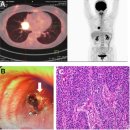 Re: hydrogen-controlled cancer: a follow-up report of 82 advanced cancer p 이미지