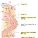 암의 특성을 알면 병기가 보인다 이미지