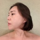 핫탄스파 | 대구윤곽관리 받고 어깨라인부터 얼굴라인까지 싹 정리된 핫탄스파 후기